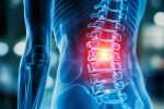 RückenTherapie bei chronischen Rückenschmerzen